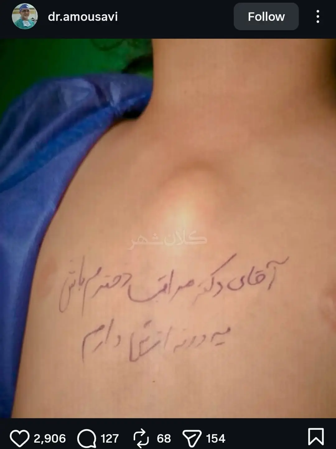 نوشته یک مادر روی بدن دختر ۴ ساله‌اش همه را تحت تأثیر قرار داد